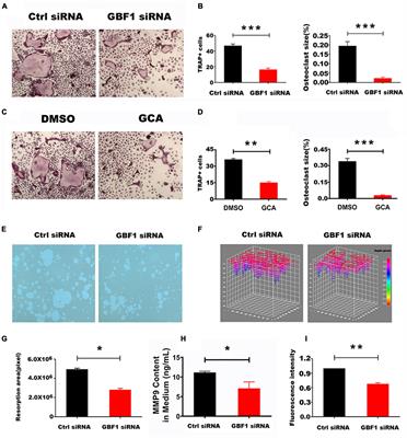 The Regulatory Role of GBF1 on Osteoclast Activation Through EIF2a Mediated ER Stress and Novel Marker FAM129A Induction